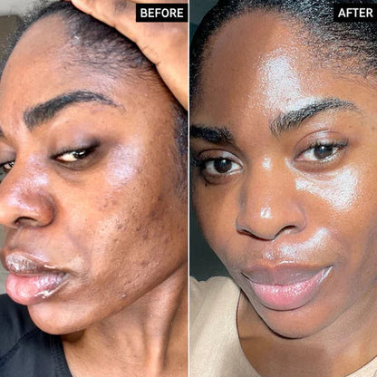 GoBare® Turmeric Corrector Bar