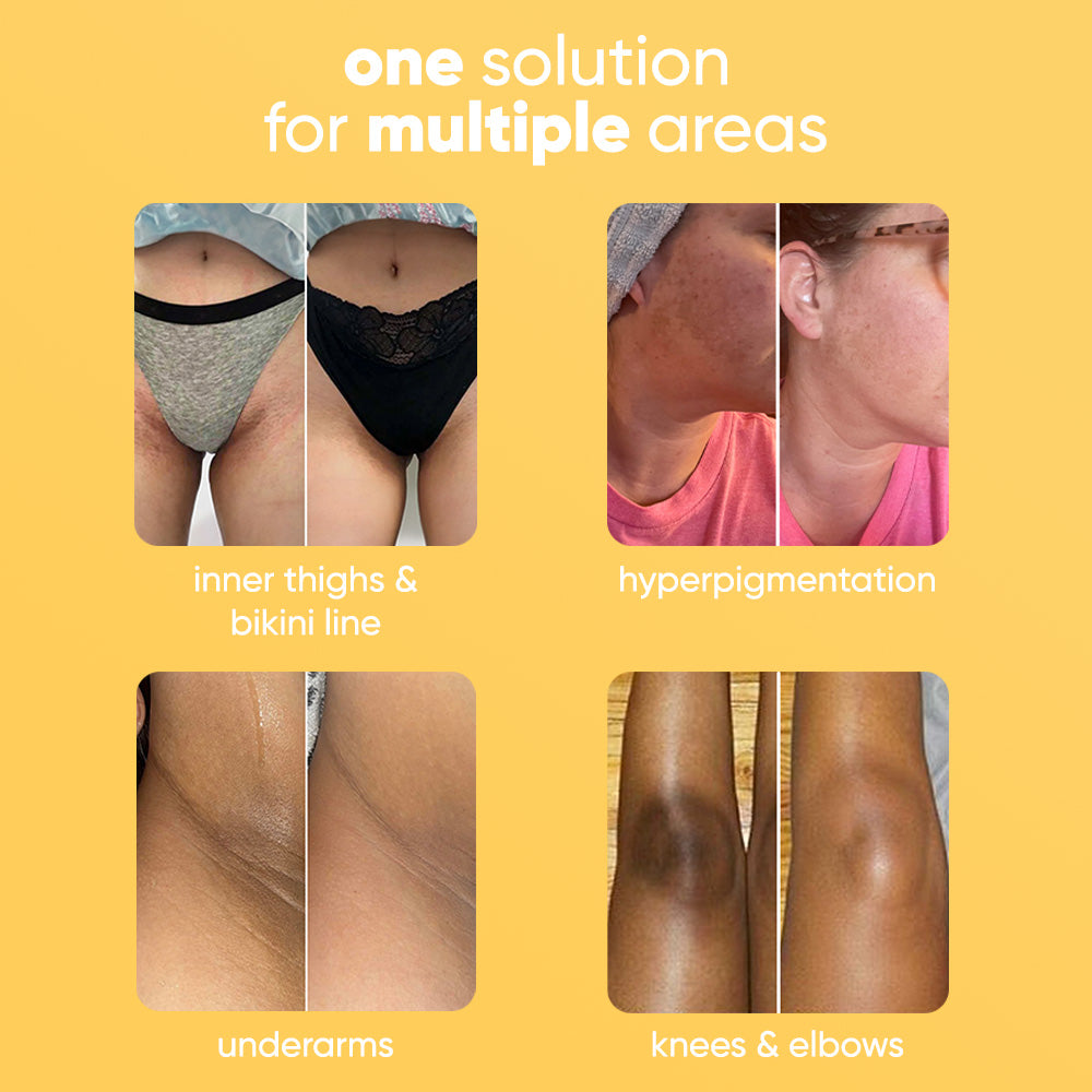 GoBare® Turmeric Corrector Bar