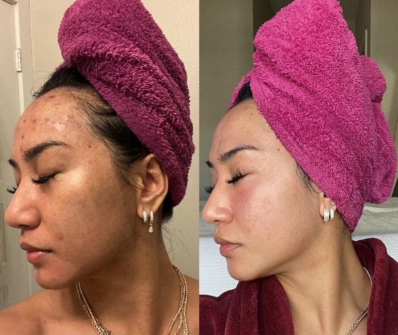 GoBare® Turmeric Corrector Bar