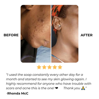GoBare® Turmeric Corrector Bar