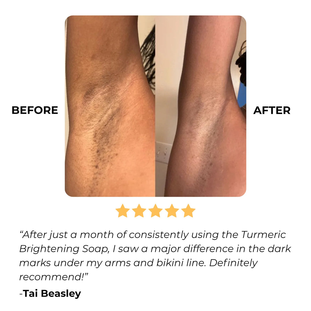 GoBare® Turmeric Corrector Bar